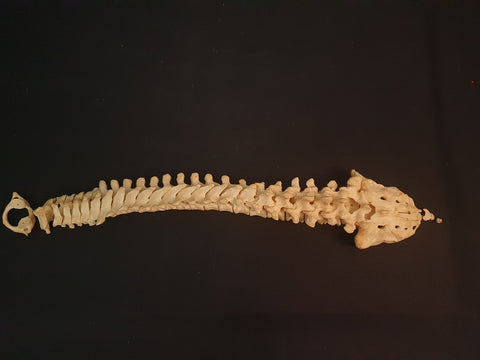 Medically prepared vertebral column / spine and sacrum showing sacralisation