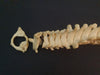  vertebral column / spine and sacrum showing sacralisation