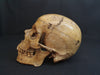 Adam Rouilly real human demonstration skull for sale