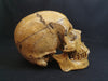 Adam Rouilly real human demonstration skull for sale