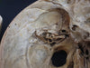 Adam Rouilly real human demonstration skull for sale