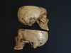 Adam Rouilly real human demonstration skull for sale