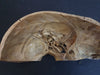 Adam Rouilly real human demonstration skull for sale