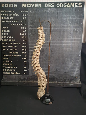 Antique articulated real human spine and sacrum showing sacralisation with stand.