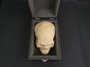 Medically prepared real human skull in case. Excellent condition