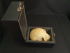 Medically prepared real human skull in case. Excellent condition