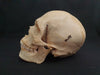 Medically prepared real human skull in case. Excellent condition