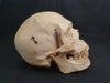 Medically prepared real human skull in case. Excellent condition